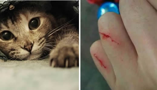 被宠物猫抓破了这一点没事吧-不用打疫苗吧 (被宠物猫抓破了一点皮有事吗)