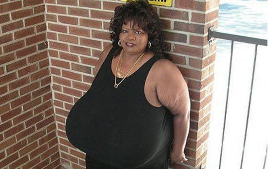 世界上最大胸重排行，安妮·霍金斯特纳胸部重达77斤知秀网 